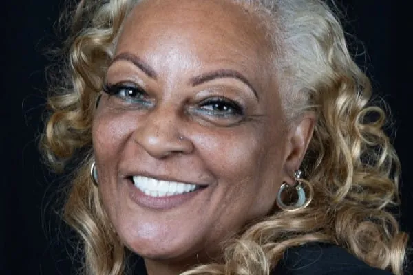 The same patient smiling after All-on-4 treatment