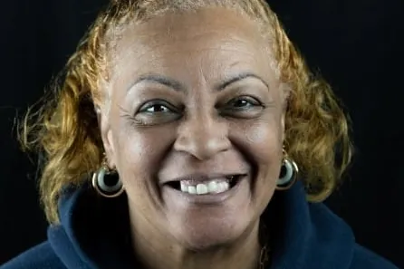 Patient smile before All-on-4 treatment