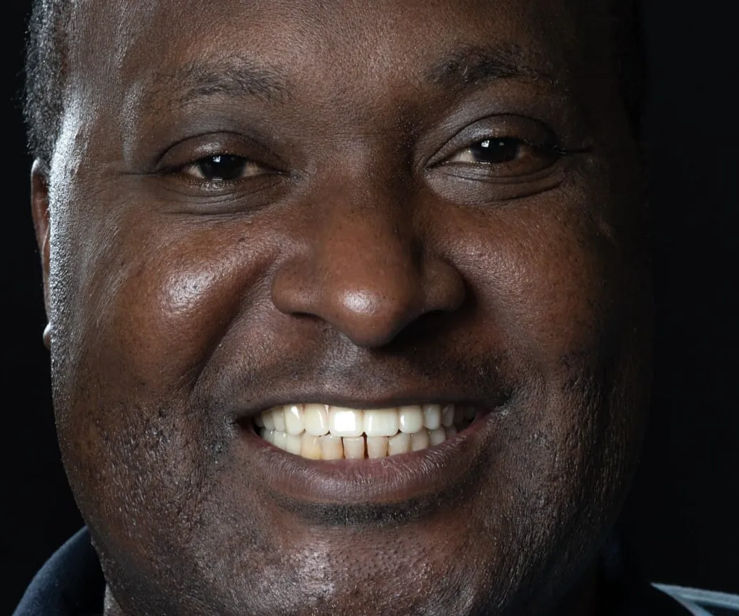 Patient smiling after All-on-4 full-arch treatment at Radiant Smile